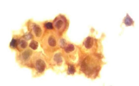 ΠΠ½ΡΡΠ°ΠΎΠΏΠ΅ΡΠ°ΡΠΈΠΎΠ½Π½ΡΠΉ ΡΠΎΡΠΊΠΎΠ± Ρ Π»Π΅Π³ΠΊΠΎΠ³ΠΎ, 5 Π΄Π΅Π½Ρ Π² Π’ΠΠ‘-1, ΠΠ¦Π₯ (Π‘Π7)