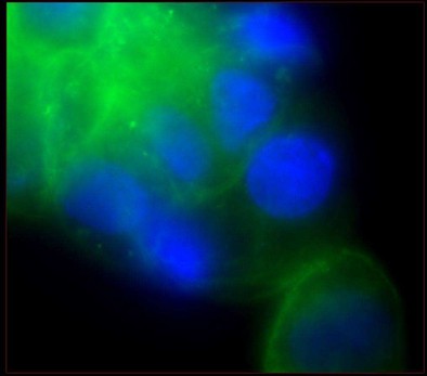 Наглядное изображение реакции прямой иммунофлуоресценции.