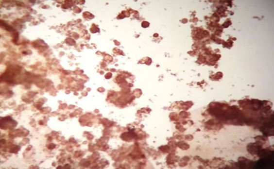 ΠΡΠ°Π΄ΠΎΠΊ Π°ΡΡΠΈΡΠΈΡΠ΅ΡΠΊΠΎΠΉ ΠΆΠΈΠ΄ΠΊΠΎΡΡΠΈ, ΠΠ¦Π₯ (Π‘R7)