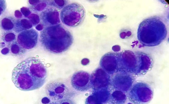 ΠΡΠ°Π΄ΠΎΠΊ Π°ΡΡΠΈΡΠΈΡΠ΅ΡΠΊΠΎΠΉ ΠΆΠΈΠ΄ΠΊΠΎΡΡΠΈ, Π’ΠΠ‘-1, 3 Π΄Π΅Π½Ρ