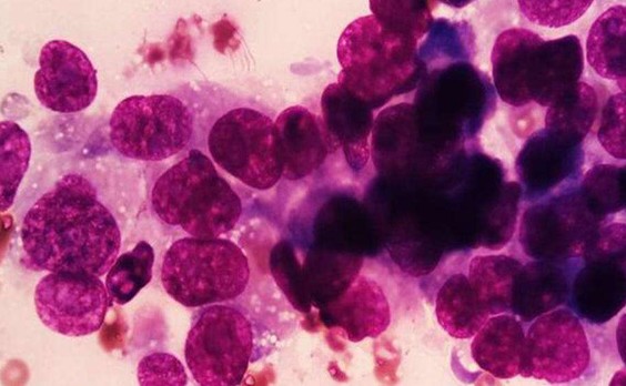 ΠΠ½ΡΡΠ°ΠΎΠΏΠ΅ΡΠ°ΡΠΈΠΎΠ½Π½ΡΠΉ ΡΠΎΡΠΊΠΎΠ± Ρ Π»Π΅Π³ΠΊΠΎΠ³ΠΎ, Π’ΠΠ‘-1, 3 Π΄Π΅Π½Ρ