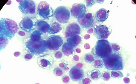 ΠΡΠ°Π΄ΠΎΠΊ Π°ΡΡΠΈΡΠΈΡΠ΅ΡΠΊΠΎΠΉ ΠΆΠΈΠ΄ΠΊΠΎΡΡΠΈ, Π’ΠΠ‘-1, 9 Π΄Π΅Π½Ρ