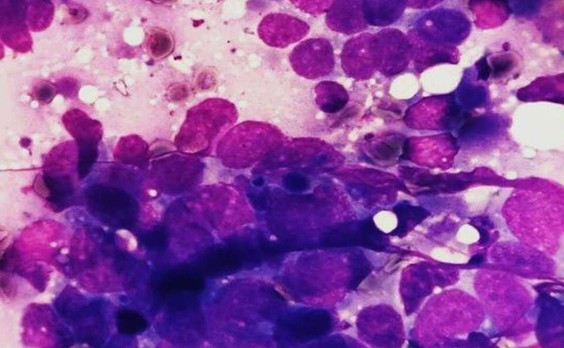 ΠΠ½ΡΡΠ°ΠΎΠΏΠ΅ΡΠ°ΡΠΈΠΎΠ½Π½ΡΠΉ ΡΠΎΡΠΊΠΎΠ± Ρ Π»Π΅Π³ΠΊΠΎΠ³ΠΎ Π΄ΠΎ Π’ΠΠ‘-1