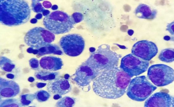 ΠΡΠ°Π΄ΠΎΠΊ Π°ΡΡΠΈΡΠΈΡΠ΅ΡΠΊΠΎΠΉ ΠΆΠΈΠ΄ΠΊΠΎΡΡΠΈ Π΄ΠΎ Π’ΠΠ‘-1