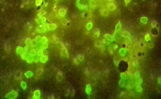 ΠΠ½ΡΡΠ°ΠΎΠΏΠ΅ΡΠ°ΡΠΈΠΎΠ½Π½ΡΠΉ ΡΠΎΡΠΊΠΎΠ± Ρ Π»Π΅Π³ΠΊΠΎΠ³ΠΎ, 5 Π΄Π΅Π½Ρ Π² Π’ΠΠ‘-1, Π€ΠΠ¦Π₯ (Π‘Π7), AlexaFluor-488