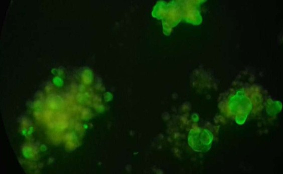 ΠΡΠ°Π΄ΠΎΠΊ Π°ΡΡΠΈΡΠΈΡΠ΅ΡΠΊΠΎΠΉ ΠΆΠΈΠ΄ΠΊΠΎΡΡΠΈ, Π€ΠΠ¦Π₯ (EpCAM/BerEP4), AlexaFluor-488